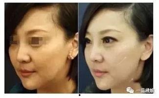 明星半脸拼接,揭秘明星半脸拼接的艺术魅力